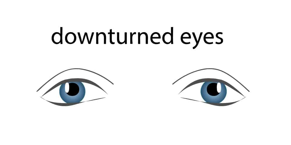 Downturned Eyes