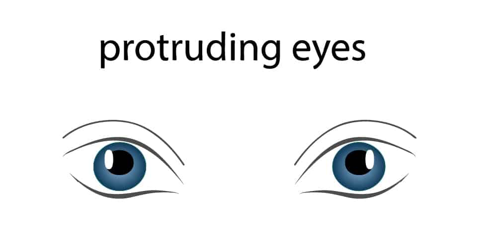 Protruding Eyes