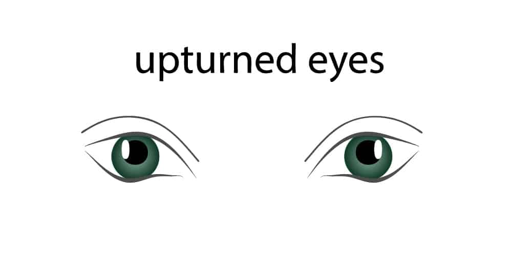 Upturned Eyes