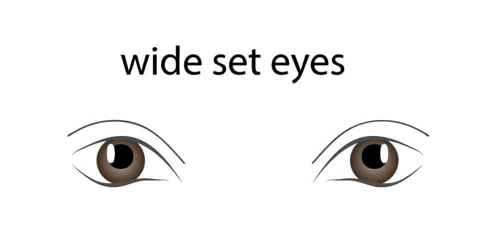 Wideset Eyes