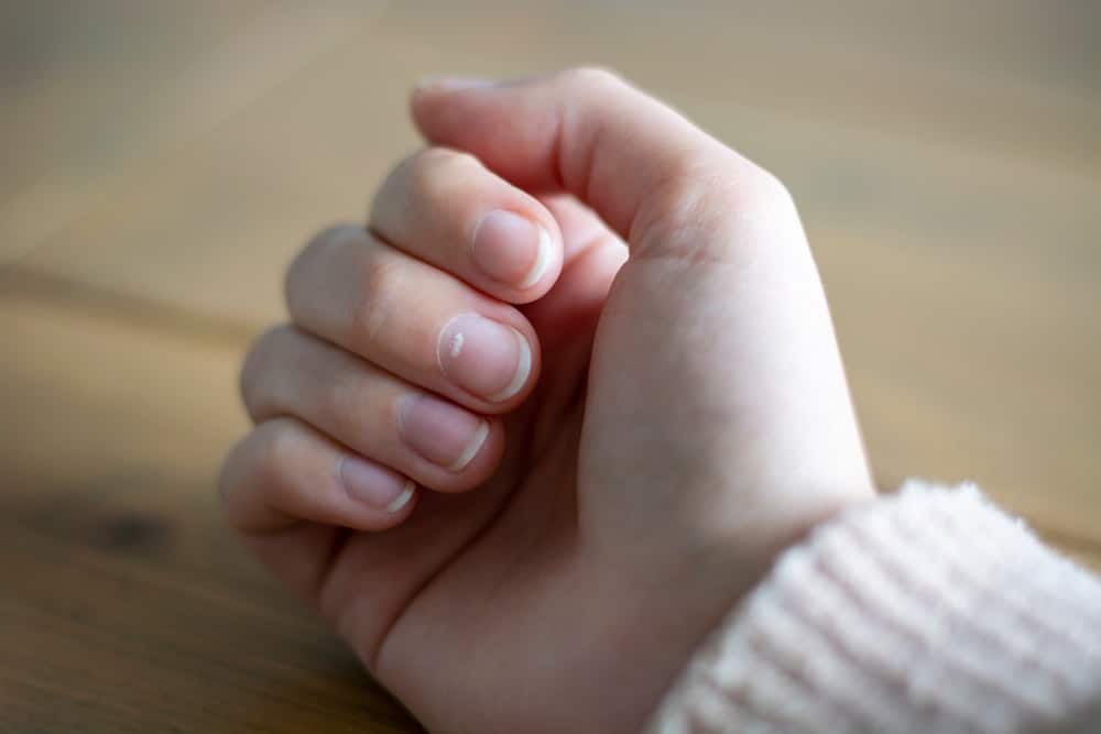 A close look at a woman's fingernails that have white spots on them.